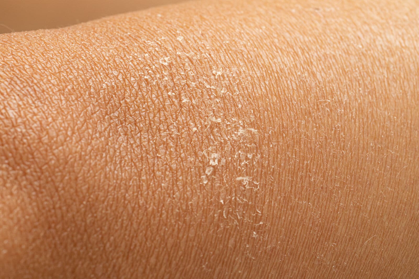 Is Your Water Damaging Your Skin & Hair?